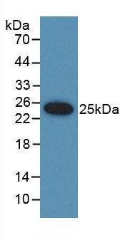 Polyclonal Antibody to Ubiquitin D (UBD)