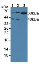 Polyclonal Antibody to Tryptophanyl tRNA Synthetase (WARS)