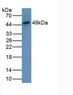 Polyclonal Antibody to Tryptophanyl tRNA Synthetase (WARS)