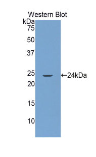 Polyclonal Antibody to Glutamate Receptor Interacting Protein 1 (GRIP1)