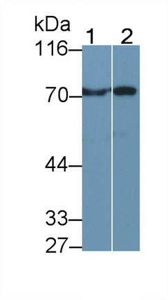 Polyclonal Antibody to Transglutaminase 3, Epidermal (TGM3)