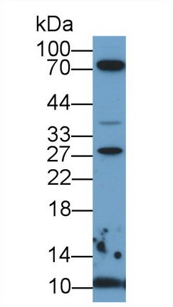 Polyclonal Antibody to S100 Calcium Binding Protein A6 (S100A6)