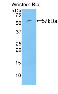 Polyclonal Antibody to Transglutaminase 1 (TGM1)
