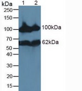 Polyclonal Antibody to Neprilysin (CD10)