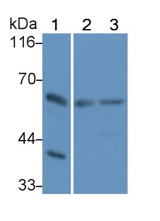 Polyclonal Antibody to Receptor Interacting Serine Threonine Kinase 2 (RIPK2)