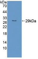 Polyclonal Antibody to Rho Family GTPase 1 (RND1)