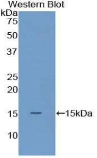 Polyclonal Antibody to S100 Calcium Binding Protein A9 (S100A9)