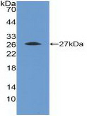 Polyclonal Antibody to Fibroblast Growth Factor Receptor 4 (FGFR4)