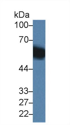 Polyclonal Antibody to Vitamin D Binding Protein (DBP)