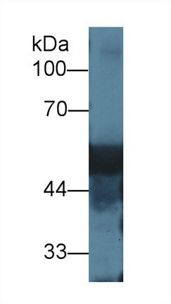 Polyclonal Antibody to Vitamin D Binding Protein (DBP)