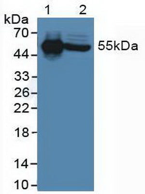 Polyclonal Antibody to Interleukin 6 Receptor (IL6R)