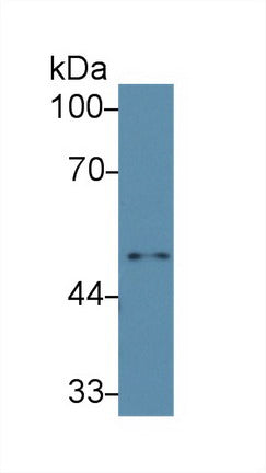Polyclonal Antibody to Interleukin 6 Receptor (IL6R)