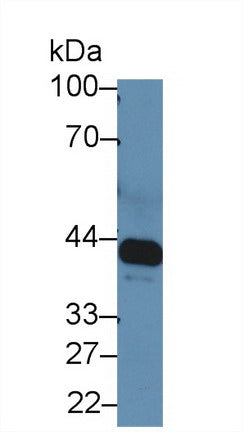 Polyclonal Antibody to Interleukin 6 Receptor (IL6R)