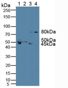 Polyclonal Antibody to Vascular Endothelial Growth Factor Receptor 1 (VEGFR1)