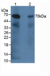 Polyclonal Antibody to Complement Component 9 (C9)