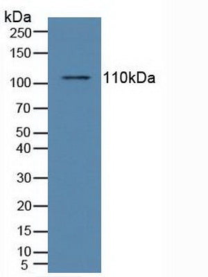 Polyclonal Antibody to Nuclear Factor Kappa B (NFkB)
