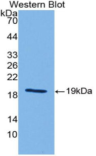 Polyclonal Antibody to Hedgehog Homolog, Sonic (SHH)