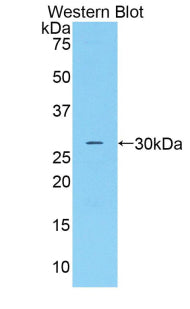 Polyclonal Antibody to Complement Factor D (CFD)