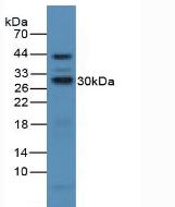 Polyclonal Antibody to Interleukin 2 Receptor Alpha (IL2Ra)
