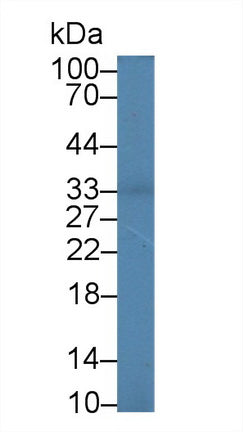 Polyclonal Antibody to Interleukin 2 Receptor Alpha (IL2Ra)