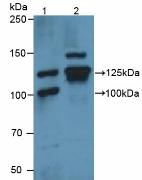 Polyclonal Antibody to Vinculin (VCL)