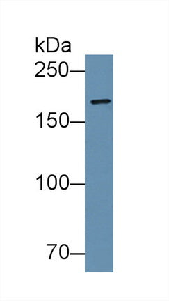Polyclonal Antibody to Vinculin (VCL)
