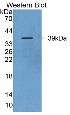Polyclonal Antibody to Small Breast Epithelial Mucin (SBEM)