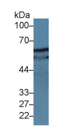 Polyclonal Antibody to Paxillin (PXN)