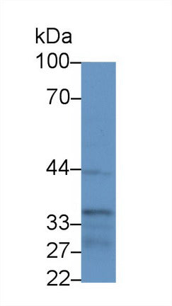Polyclonal Antibody to Inhibitory Subunit Of NF Kappa B Beta (IkBb)