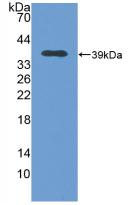 Polyclonal Antibody to Metallothionein 2 (MT2)