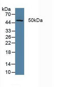 Polyclonal Antibody to Xeroderma Pigmentosum, Complementation Group G (XPG)
