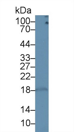 Polyclonal Antibody to Cluster Of Differentiation 3d (CD3d)