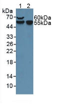 Polyclonal Antibody to Coagulation Factor VII (F7)