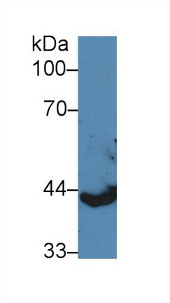 Polyclonal Antibody to Cytokeratin 13 (CK13)