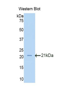 Polyclonal Antibody to Oxidosqualene Cyclase (OSC)