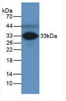 Polyclonal Antibody to Ficolin 3 (FCN3)