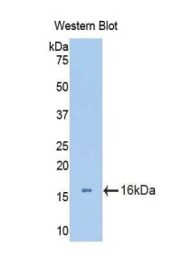 Polyclonal Antibody to Aggrecan (AGC)