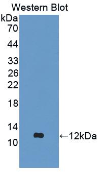 Polyclonal Antibody to Aggrecan (AGC)