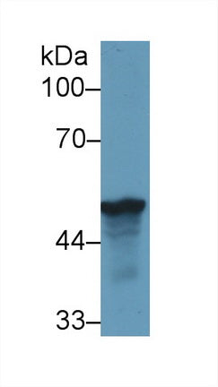 Polyclonal Antibody to Leucine Rich Alpha-2-Glycoprotein 1 (LRG1)