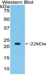 Polyclonal Antibody to Toll Like Receptor 7 (TLR7)