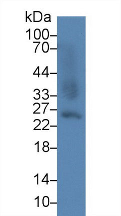 Polyclonal Antibody to Glutathione S Transferase Alpha 2 (GSTa2)