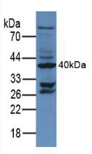 Polyclonal Antibody to Cluster Of Differentiation 34 (CD34)