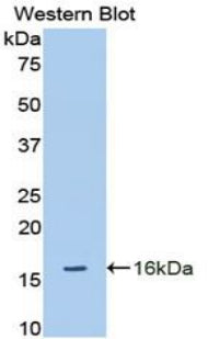 Polyclonal Antibody to A Disintegrin And Metalloproteinase With Thrombospondin 1 (ADAMTS1)
