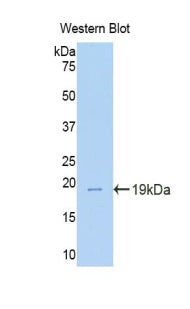 Polyclonal Antibody to Tenascin C (TNC)