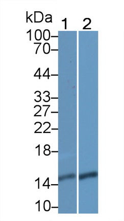Polyclonal Antibody to Fatty Acid Binding Protein 5 (FABP5)