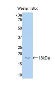 Polyclonal Antibody to Hemopexin (HPX)