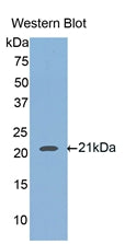 Polyclonal Antibody to Hemojuvelin (HJV)