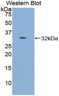 Polyclonal Antibody to Cadherin 16 (CDH16)