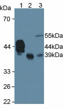 Polyclonal Antibody to Haptoglobin Related Protein (HPR)