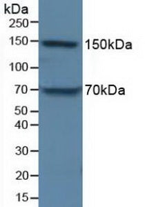 Polyclonal Antibody to Apolipoprotein B (APOB)